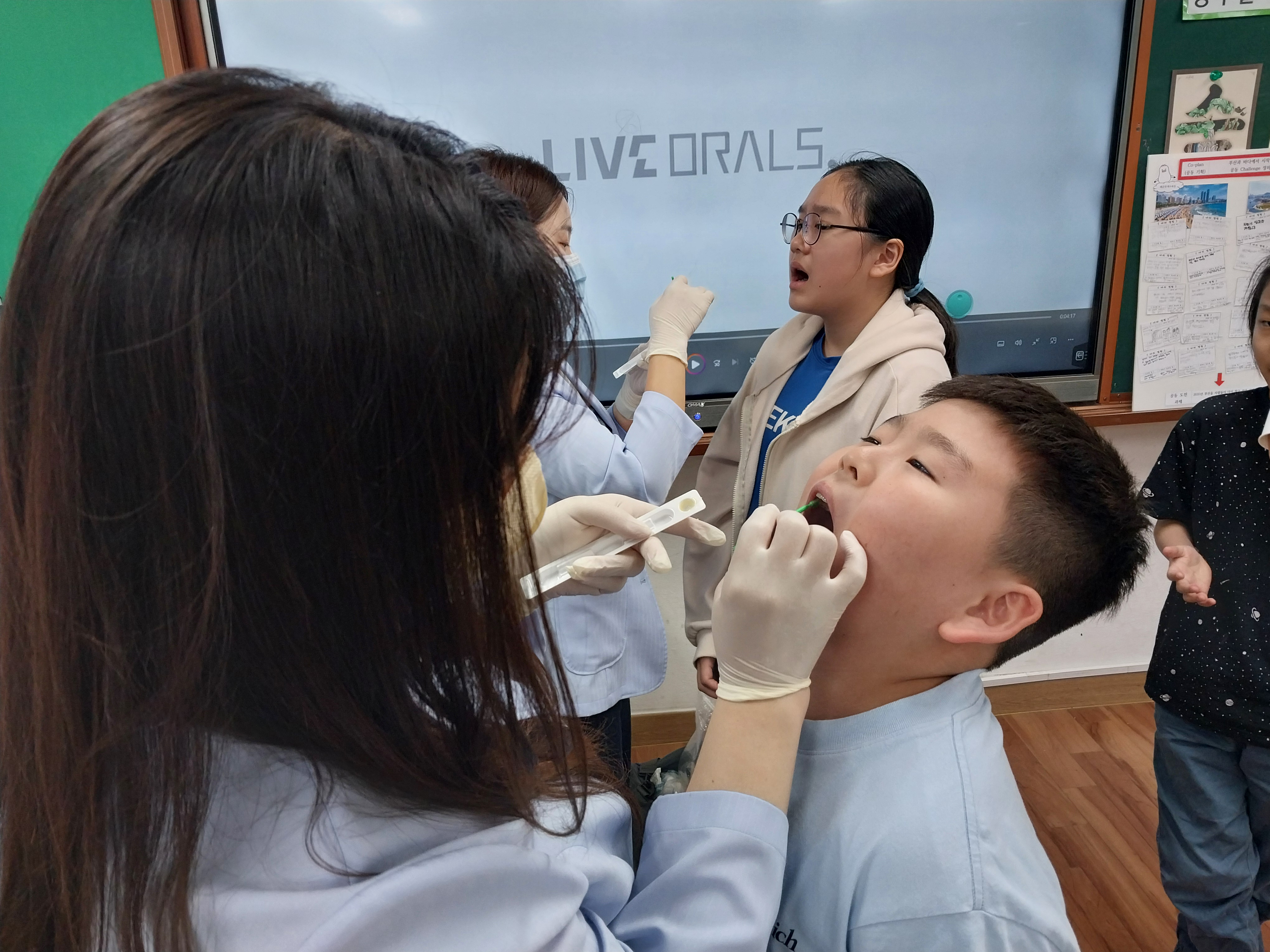 4. 아~ 입을 크고 씩씩하게! 충치를 막아주는 보호막을 씌워요.jpg